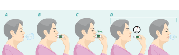 LUPIN | Tiotropium Bromide Inhalation Powder Capsule